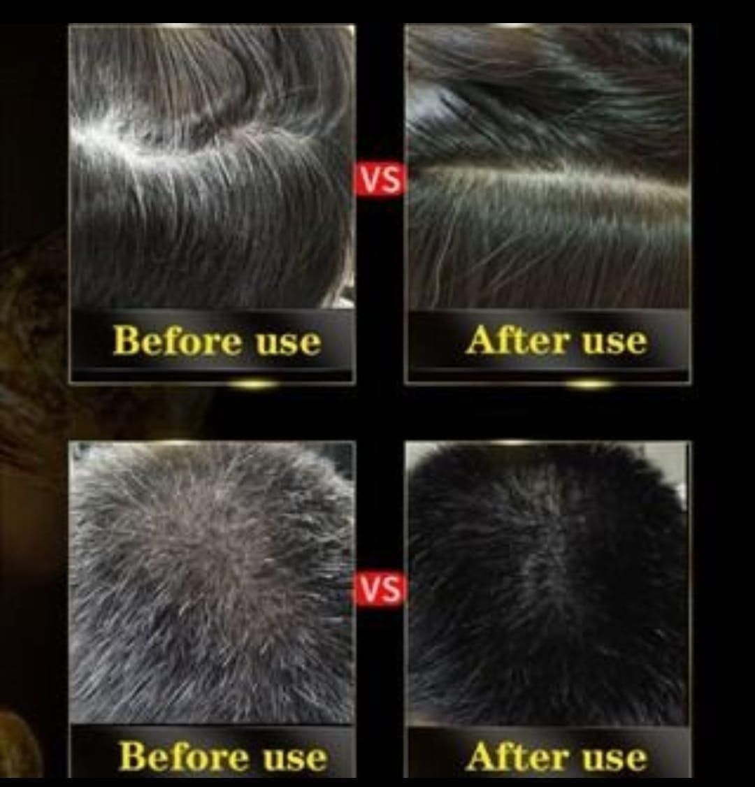 5-Minute Instant Black Hair Shampoo | 🔥FLAT 50% OFF SAVING🔥