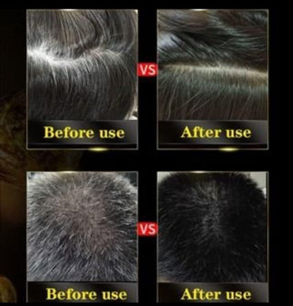 5-Minute Instant Black Hair Shampoo | 🔥FLAT 50% OFF SAVING🔥